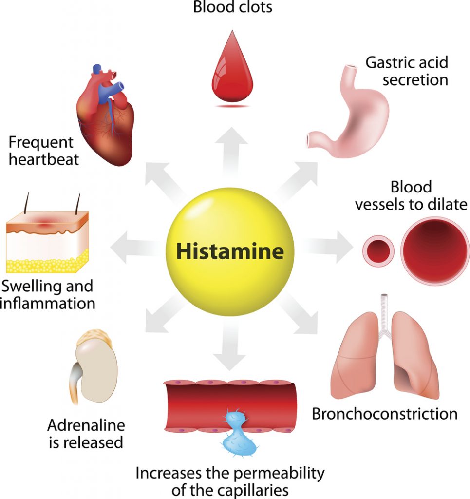 low-histamine-diet-for-jess-health-empowerment